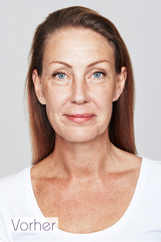 Ammi - vorher