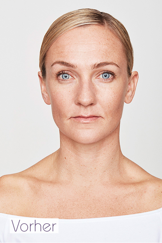Sofia - vorher